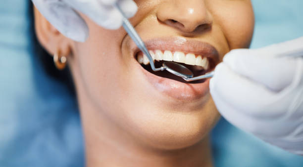 Best Broken or Chipped Tooth Repair in Cleveland, NC